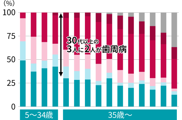 30代以上の3人に2人が歯周病に。知らず知らずに症状が進行