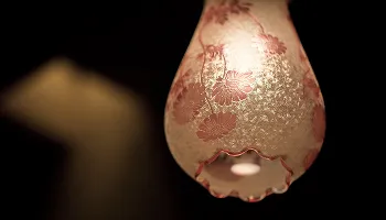 インプラント